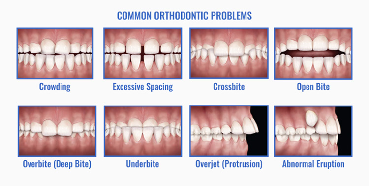 common ortho problems